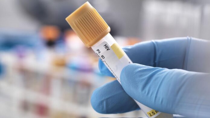 Caz medical extrem de rar: Bărbat vindecat de HIV după transplant de celule stem de la frate