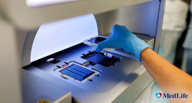 Testul genetic care poate indica riscul unor boli autoimune: o perspectivă asupra diagnosticului precoce și managementului